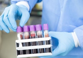 Japón desarrolla sangre artificial compatible con cualquier grupo sanguíneo